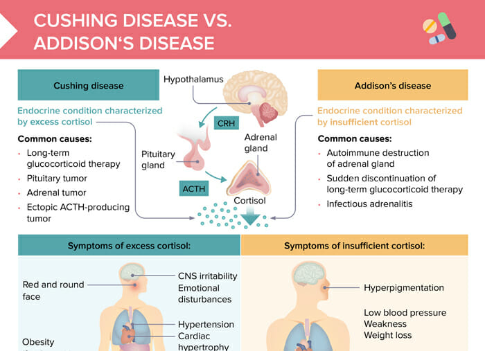 Addison's vs cushing's disease chart