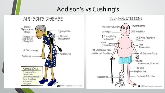 Addison's vs cushing's disease chart